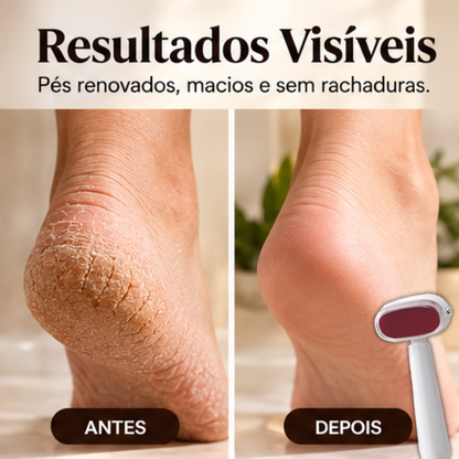🦶 SoleSmooth™ Foot File — Pés Lisos e Macios em Casa